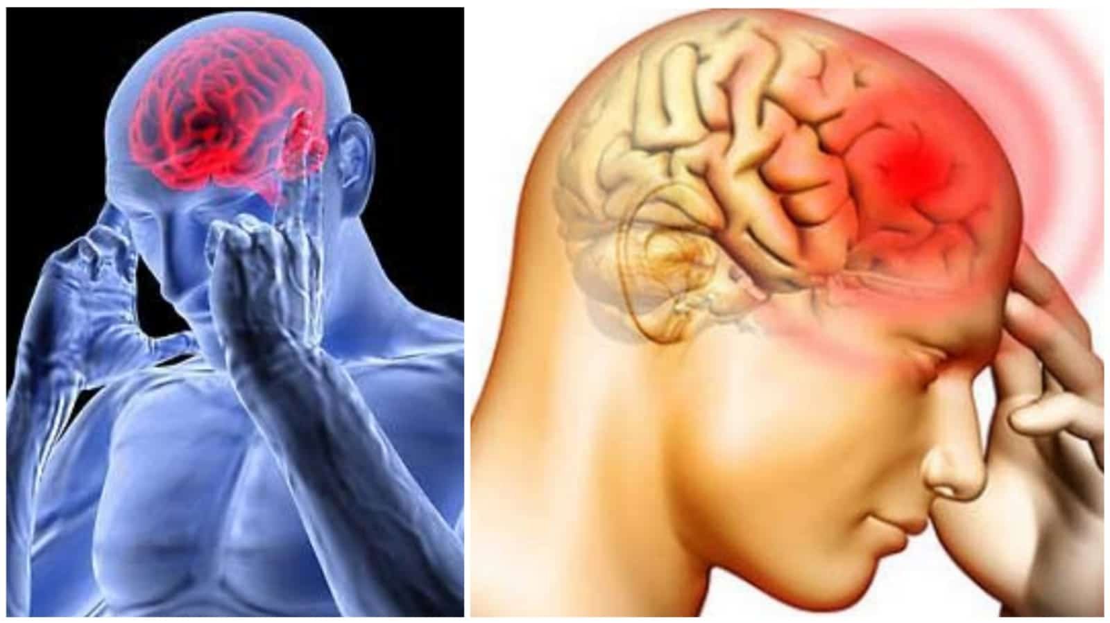 Rely on home remedies, not medicines to reduce headaches